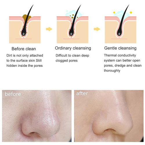 Electric Facial Cleansing Brush