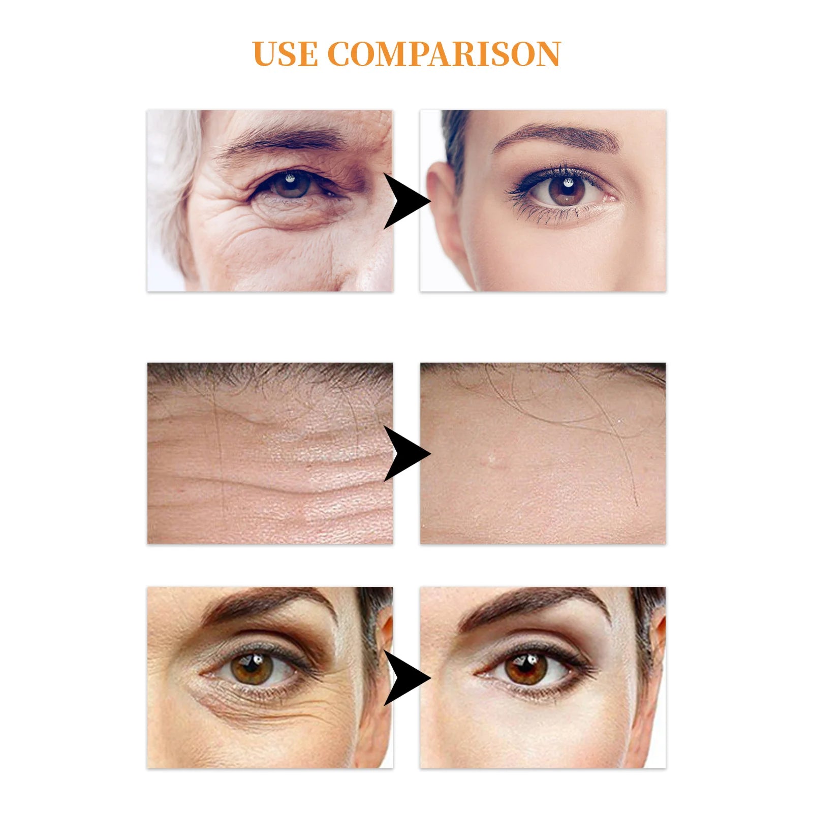 Collagen Eye Patches – Dark Circles & Puffiness (10 Pairs)
